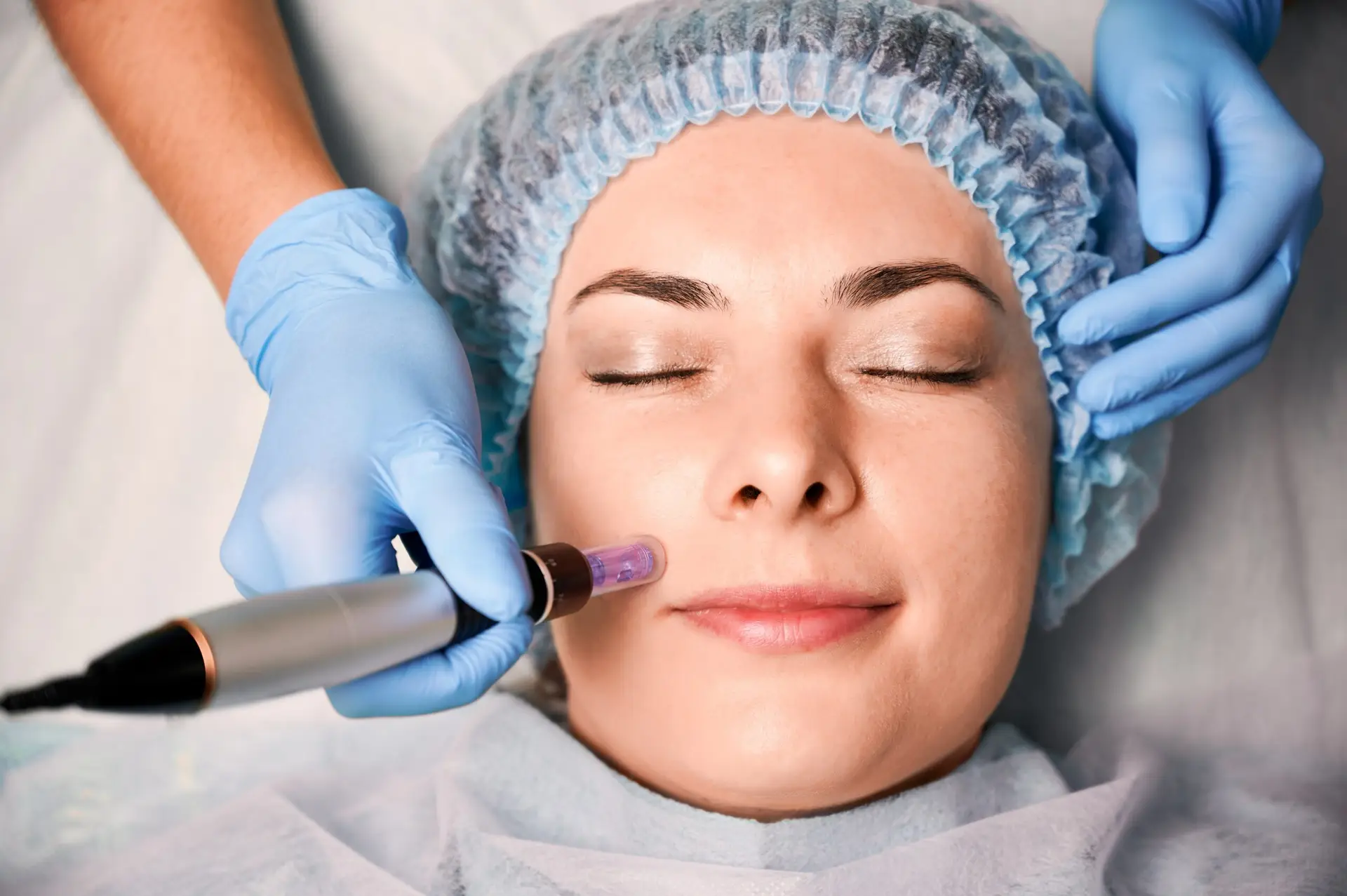 close,up,of,beautician,hands,in,sterile,gloves,using,dermapen