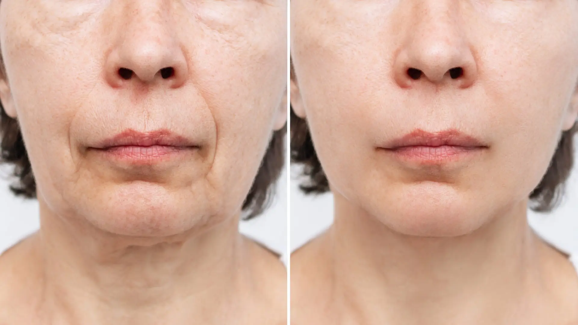 lower,part,of,face,and,neck,of,elderly,woman,with